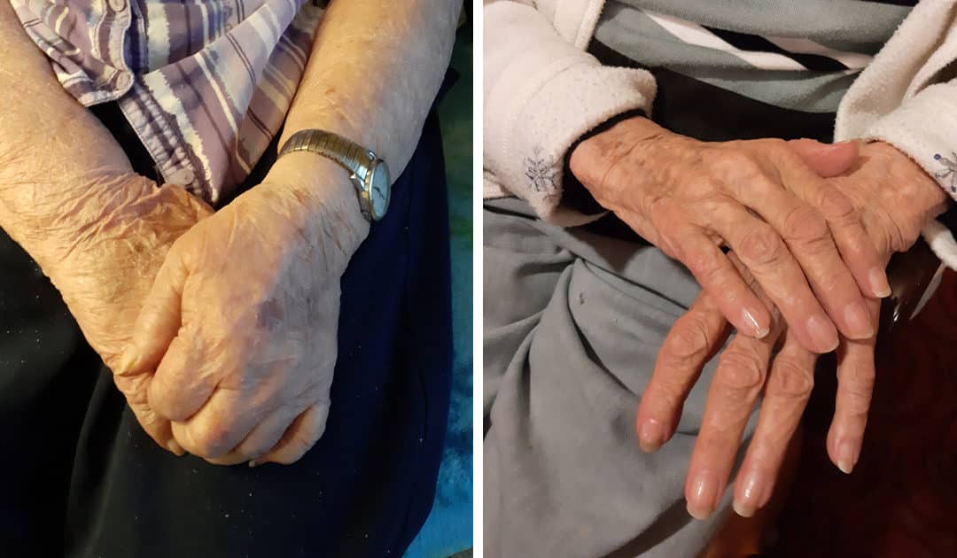 hands of 100 year old residents